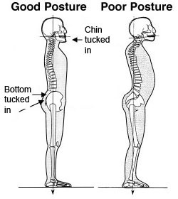 posture 2 - Ability Rehabilitation