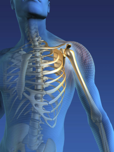 Total Shoulder and Elbow Replacements - Ability Rehabilitation
